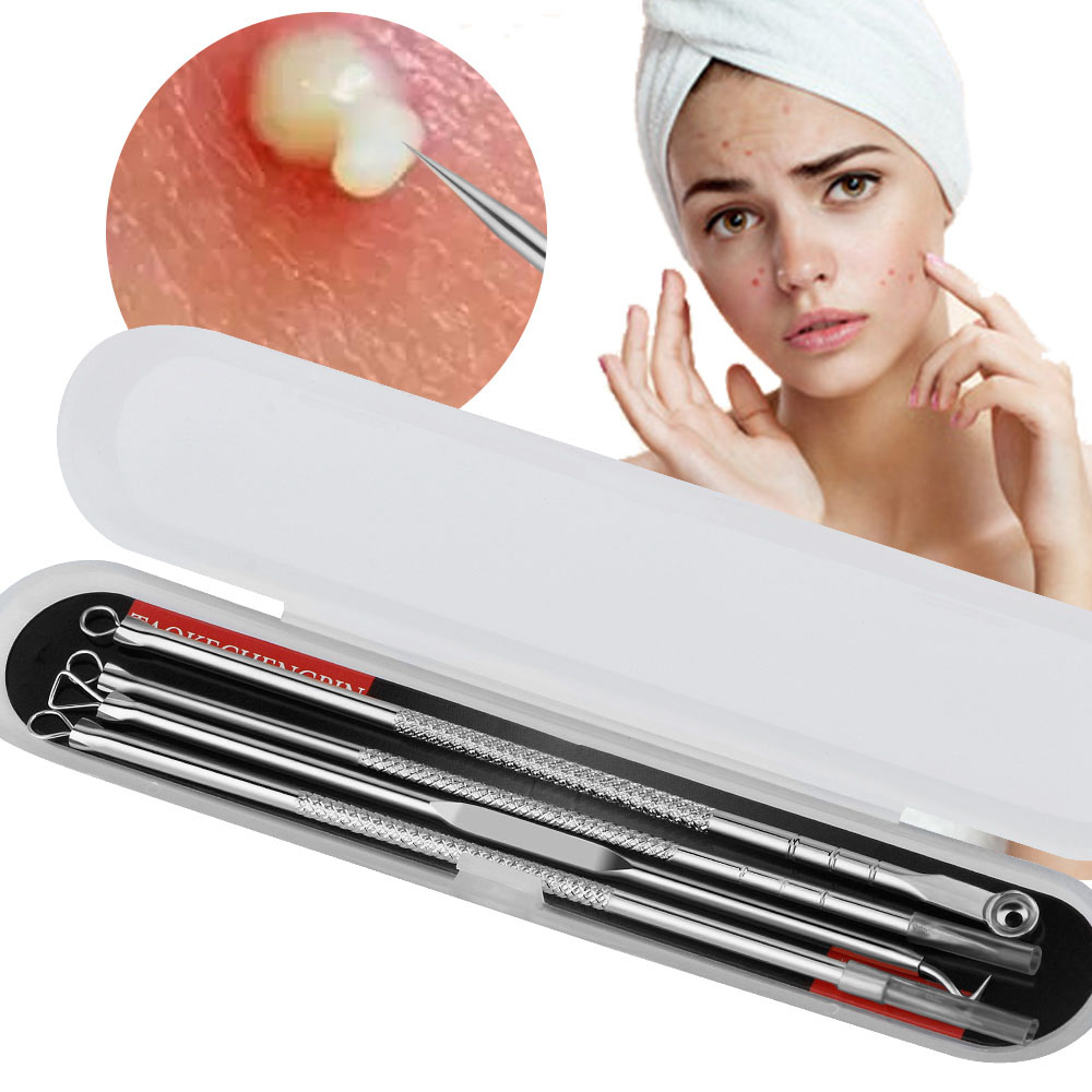 4 pz Comedone Acne Remover Set - Power Tools Total recensione e prezzo